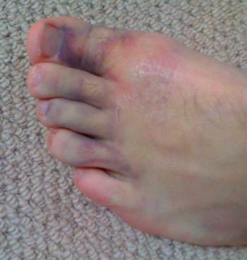 da foot.jpg (16401 bytes)